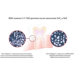 Ополіскувач Emofluor Daily Care для порожнини рота 400мл